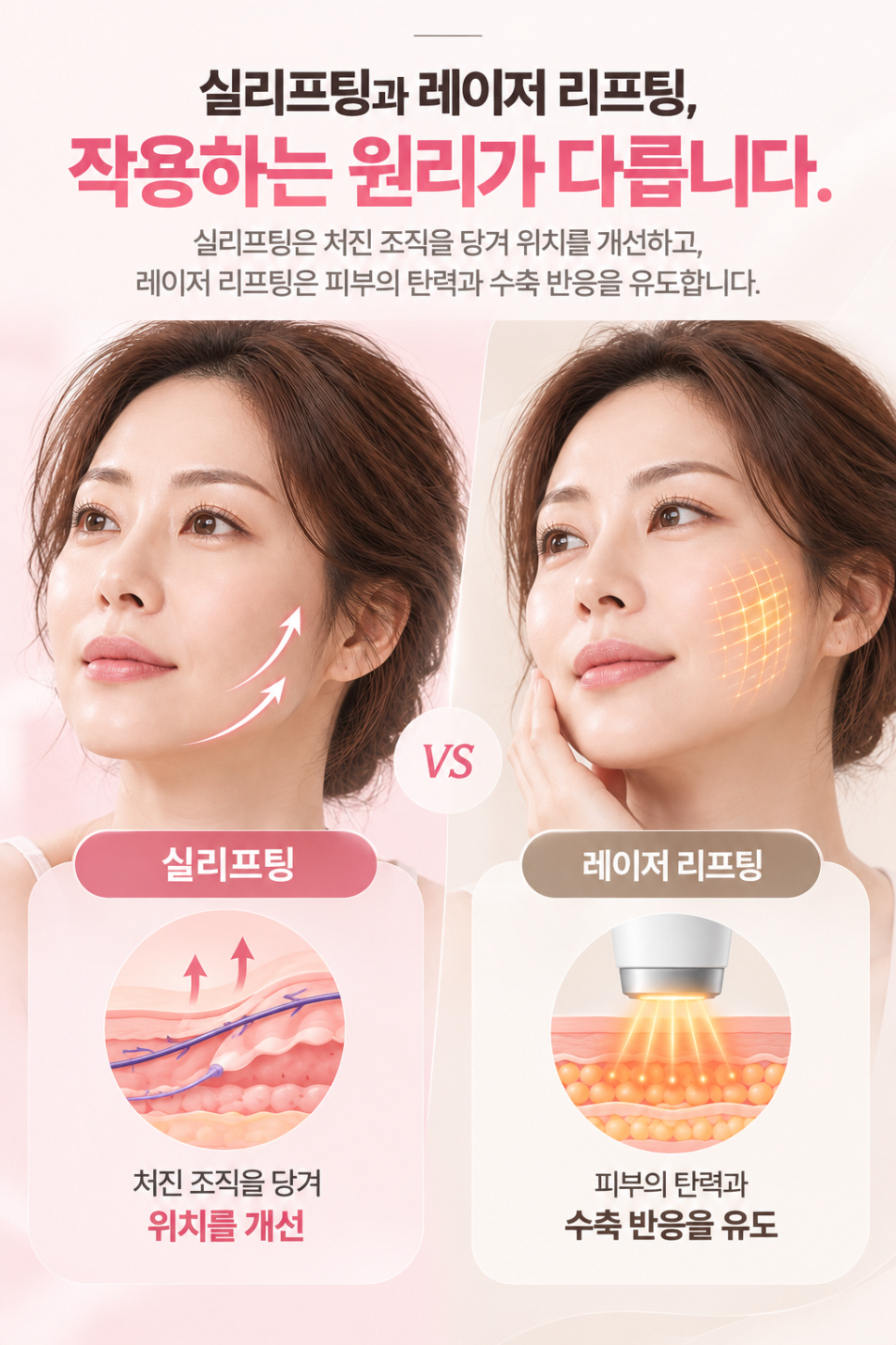실리프팅 후 얼굴 처짐 원인 무엇일까, 개인별 시술 중요한 이유 관련 이미지 4