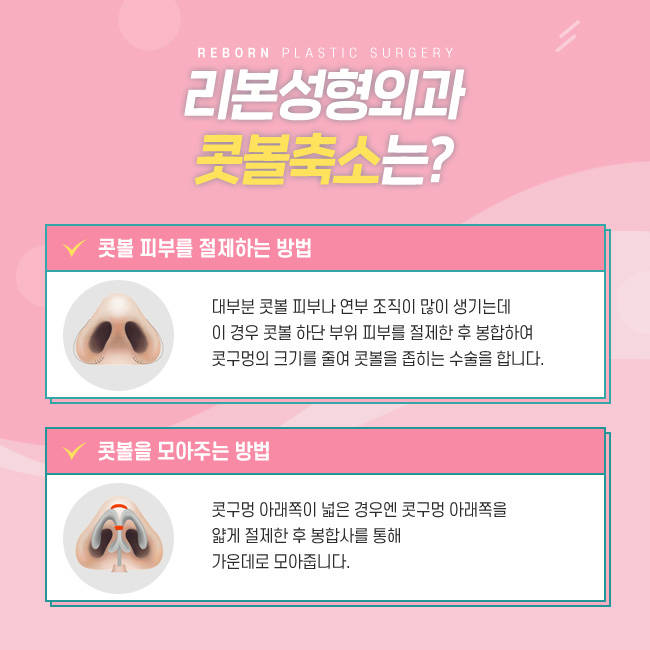 논현동콧볼축소 자연스럽지만 확실하게 관련 이미지 3