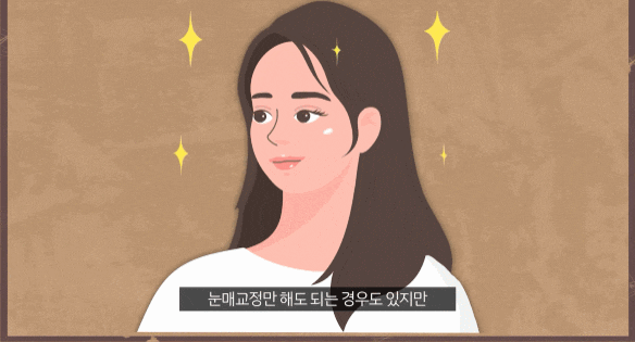 If You Have Uneven Eyelid Correction in Nonhyeon-dong, You Should Not Have Double Eyelid Surgery Alone. image 5