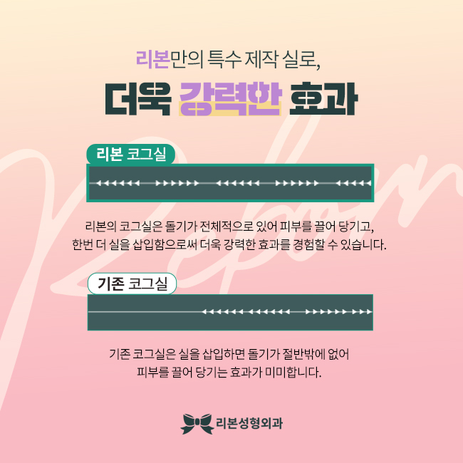 리본성형외과 리본리프팅과 함께 한다면 관련 이미지 2