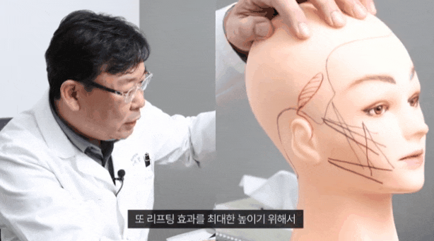 For Those Planning a Face Sagging Procedure image 3