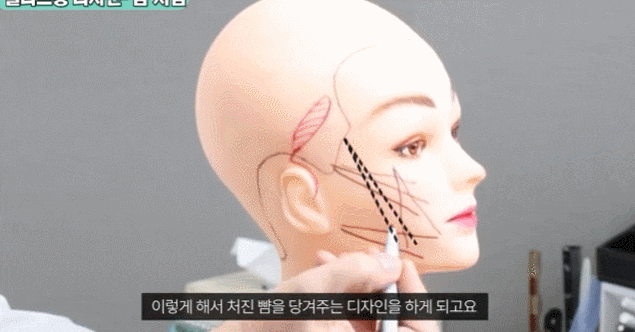 신사동 실리프팅 관련 이미지 2