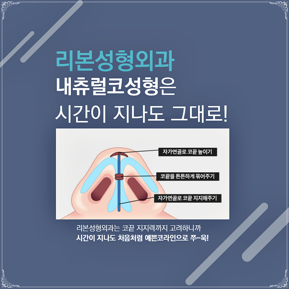 남자코성형전후 확실히 달라지고 싶다면? 관련 이미지 5