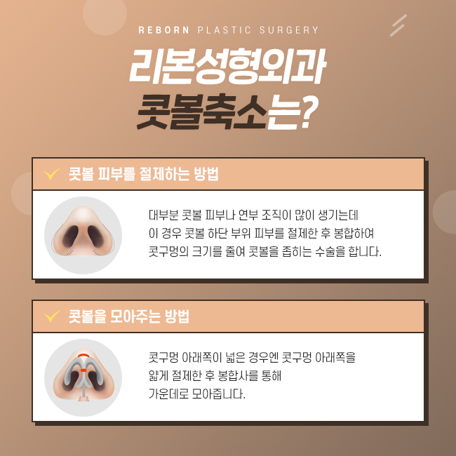 압구정콧볼축소 줄여서 예쁘게 관련 이미지 3