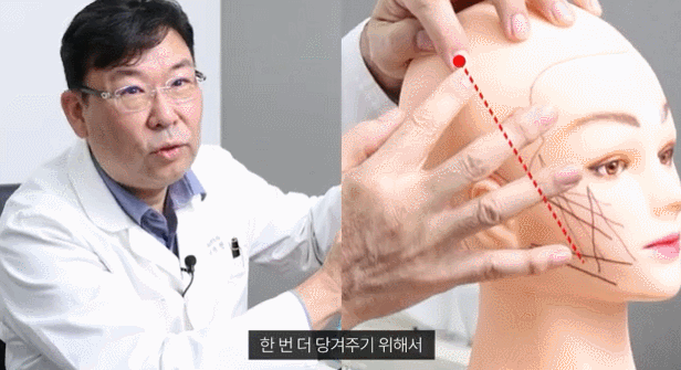 논현동실리프팅 성형외과 찾을 때 이 부분 유의하세요 관련 이미지 2