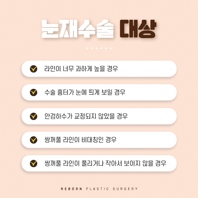 압구정역성형외과 마지막 눈재수술, 시작 관련 이미지 3