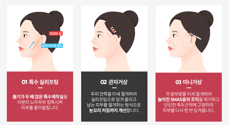 Facial Wrinkle Lifting Review, for an Effective Procedure image 3