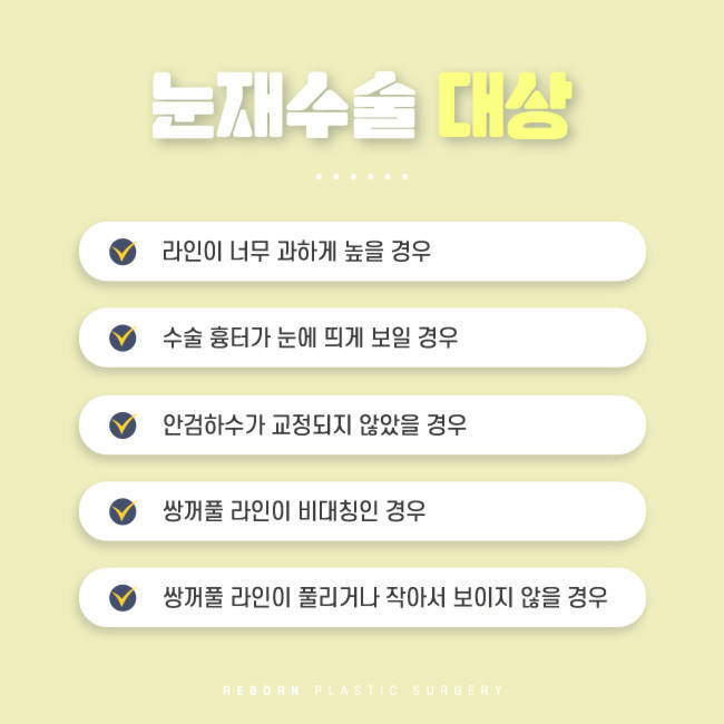 강남눈재수술 이번엔 성공하자 관련 이미지 3