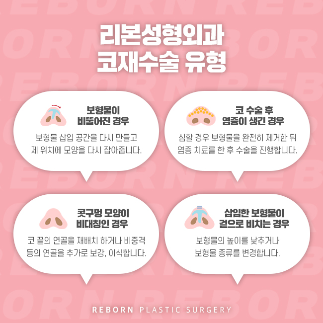 신사동성형외과 오로지 나만을 위한 코재수술 관련 이미지 3