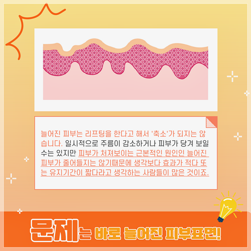 더욱 커진 효과! 더욱 긴 지속력! 관자놀이거상? 관련 이미지 4