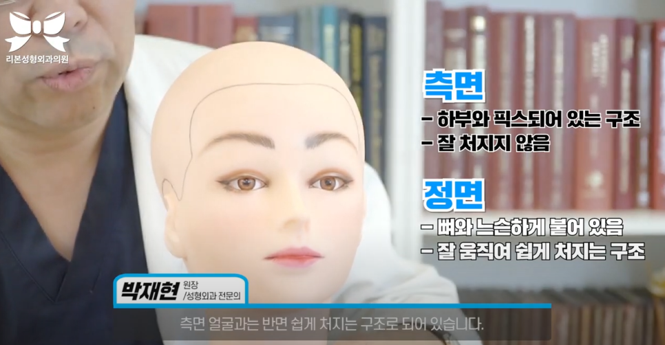 Apgujeong Lifting: If You Can’t Stop Time, Overcome It! image 3