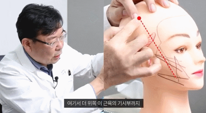 신사동 실리프팅, 여러분이 쉽게 놓치는 여러 부분들 관련 이미지 4