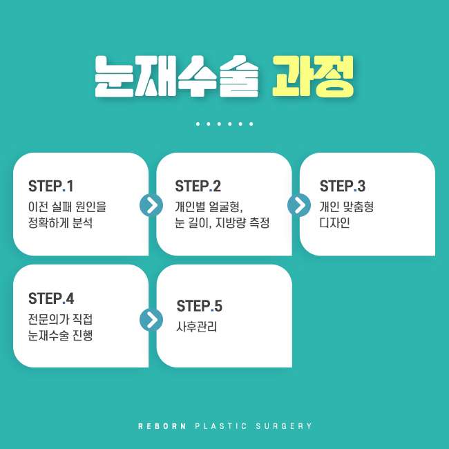 신논현눈재수술 만족스러움을 높이고 싶다면 관련 이미지 2