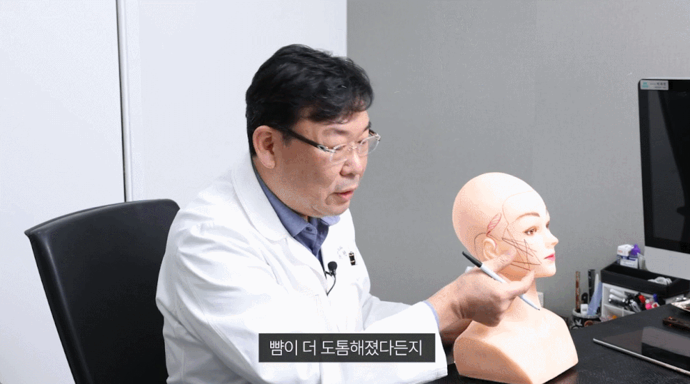 실리프팅 멍 붓기 언제까지 지속되나요? 관련 이미지 3