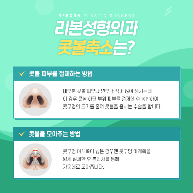신사역콧볼축소 펑퍼짐한 코를 세련되게 관련 이미지 3