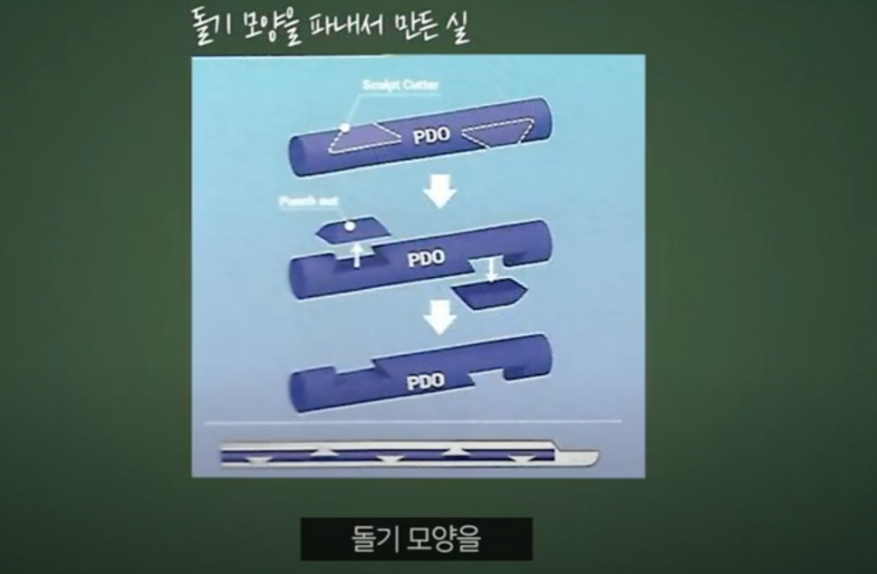 압구정 리프팅실종류 제작까지 직접 참여하는 관련 이미지 4