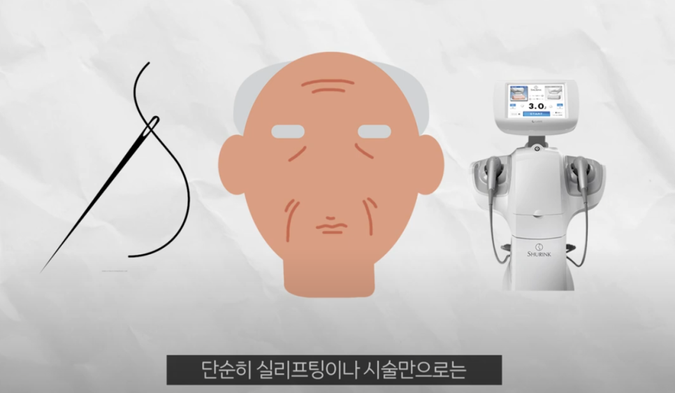 압구정 얼굴리프팅 적당한 때를 리본성형외과와 알아보자 관련 이미지 7