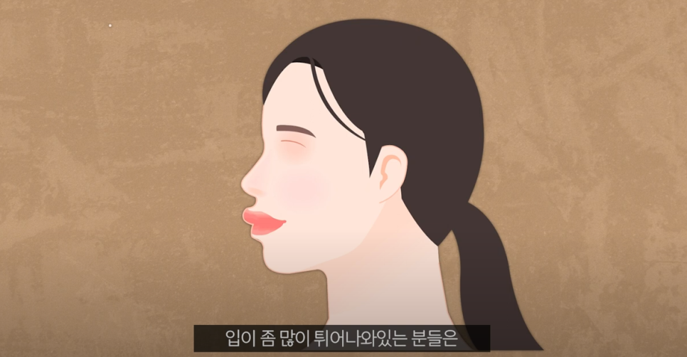 신논현성형외과 주름개선 후기 관련 이미지 2