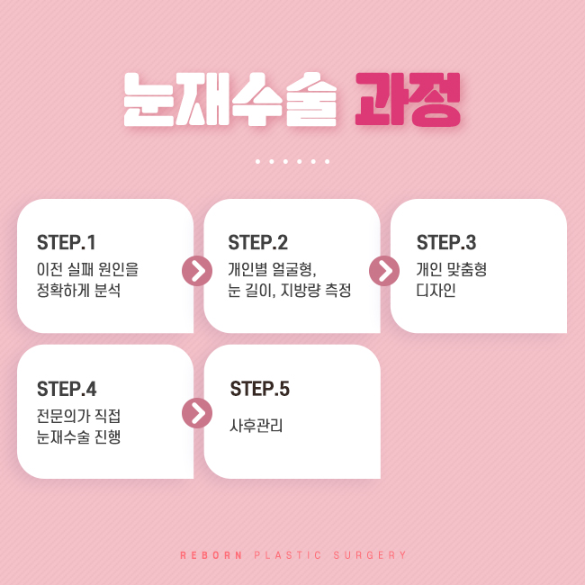 압구정눈재수술 라인 바꾸기를 원한다면 관련 이미지 2