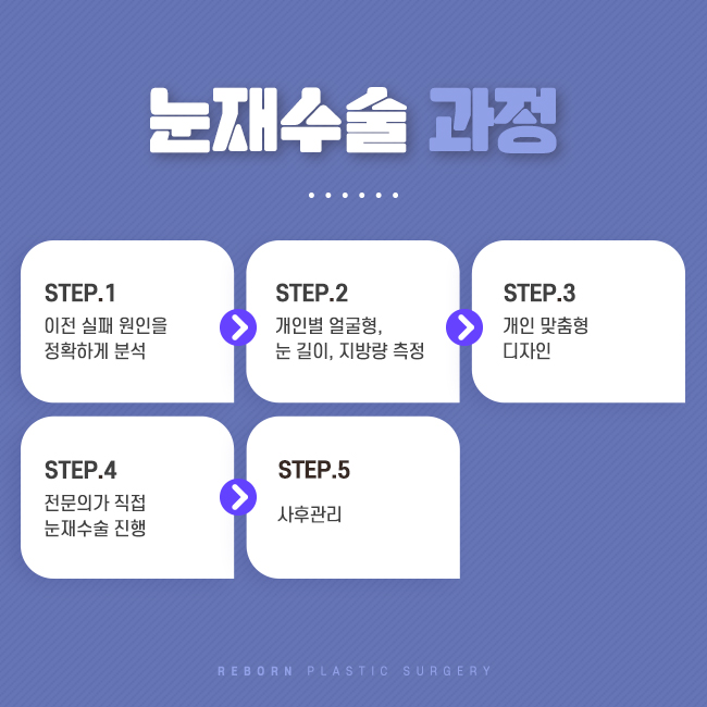 압구정눈재수술 마지막 성형, 이곳에서 관련 이미지 2