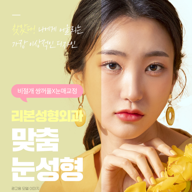 압구정역눈성형 매력 넘치는 눈매 관련 이미지 1