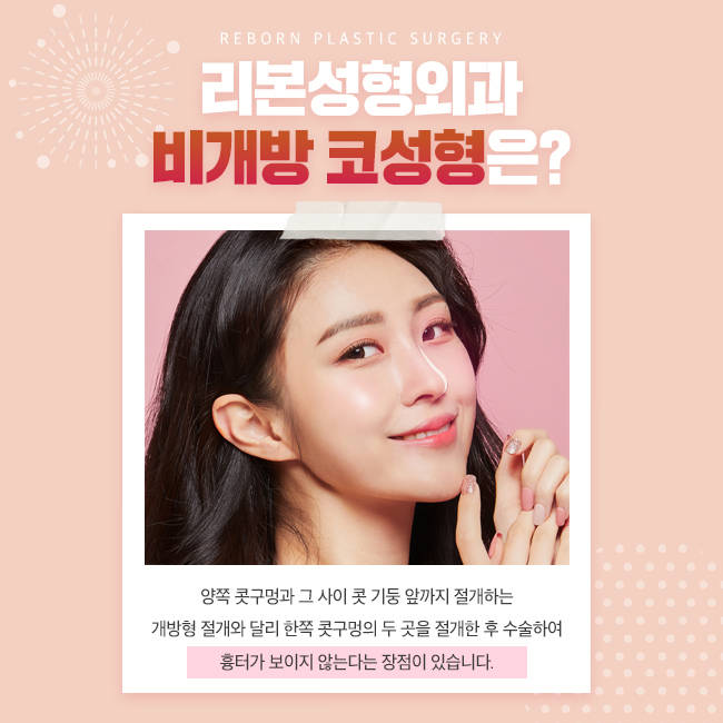 강남구비개방코성형 지금이 적기? 관련 이미지 2