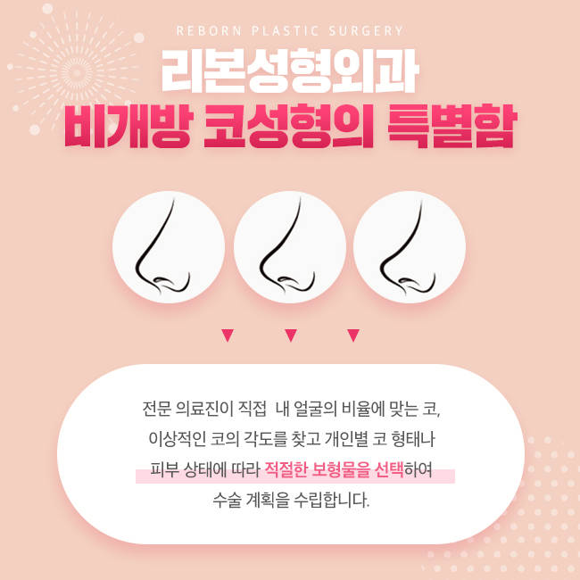 강남구비개방코성형 지금이 적기? 관련 이미지 4