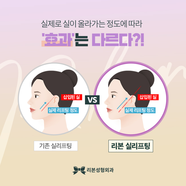 신사역성형외과 슬림하게 변하는 방법 관련 이미지 3