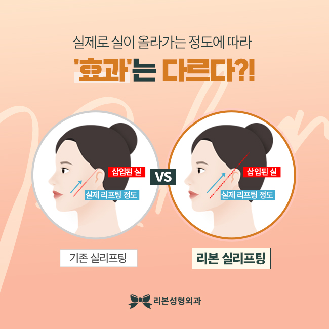 신논현역리프팅 슬림하게 탄력을 동시에! 관련 이미지 3
