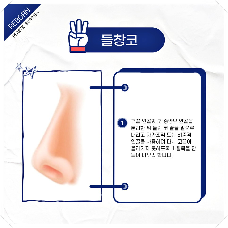 코 모양 종류 어떤 것도 상관없이 예쁜 코 만드세요! 관련 이미지 4