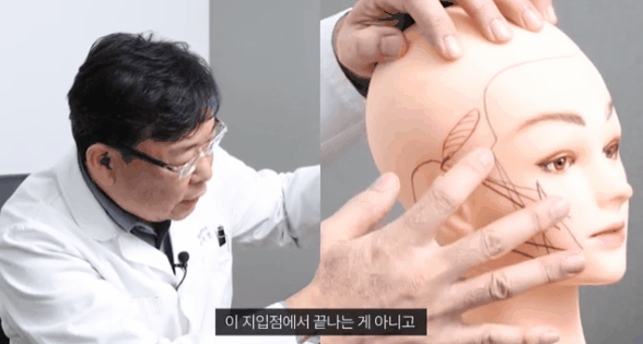 중안부리프팅 가격, 후기 궁금하신 분들에게 관련 이미지 3
