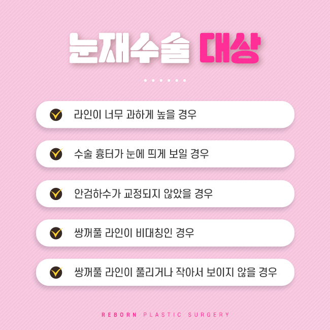 압구정눈재수술 다시 한번, 마지막으로 관련 이미지 3