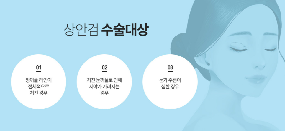 신사동성형외과 상안검수술 효과 없는 분들 특징 관련 이미지 4