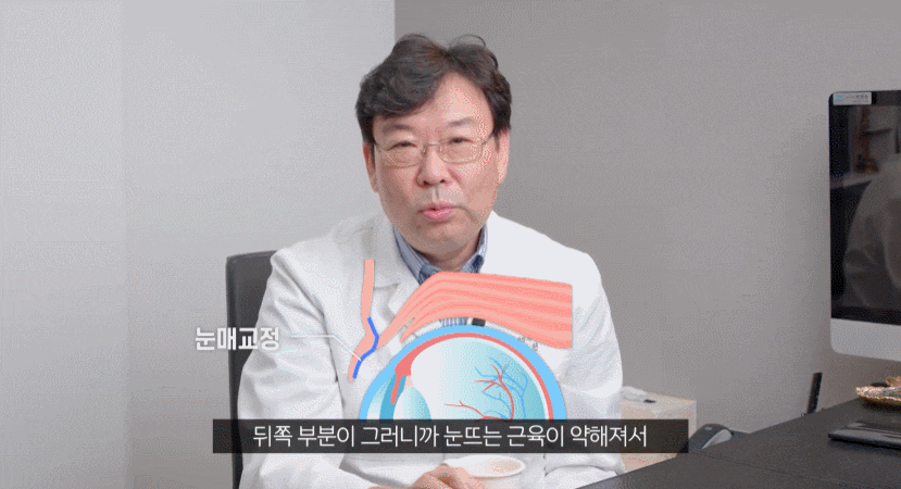 Sinsa Station Eye Plastic Surgery? For Those Who Want Double Eyelid Surgery and Ptosis Correction at the Same Time image 4