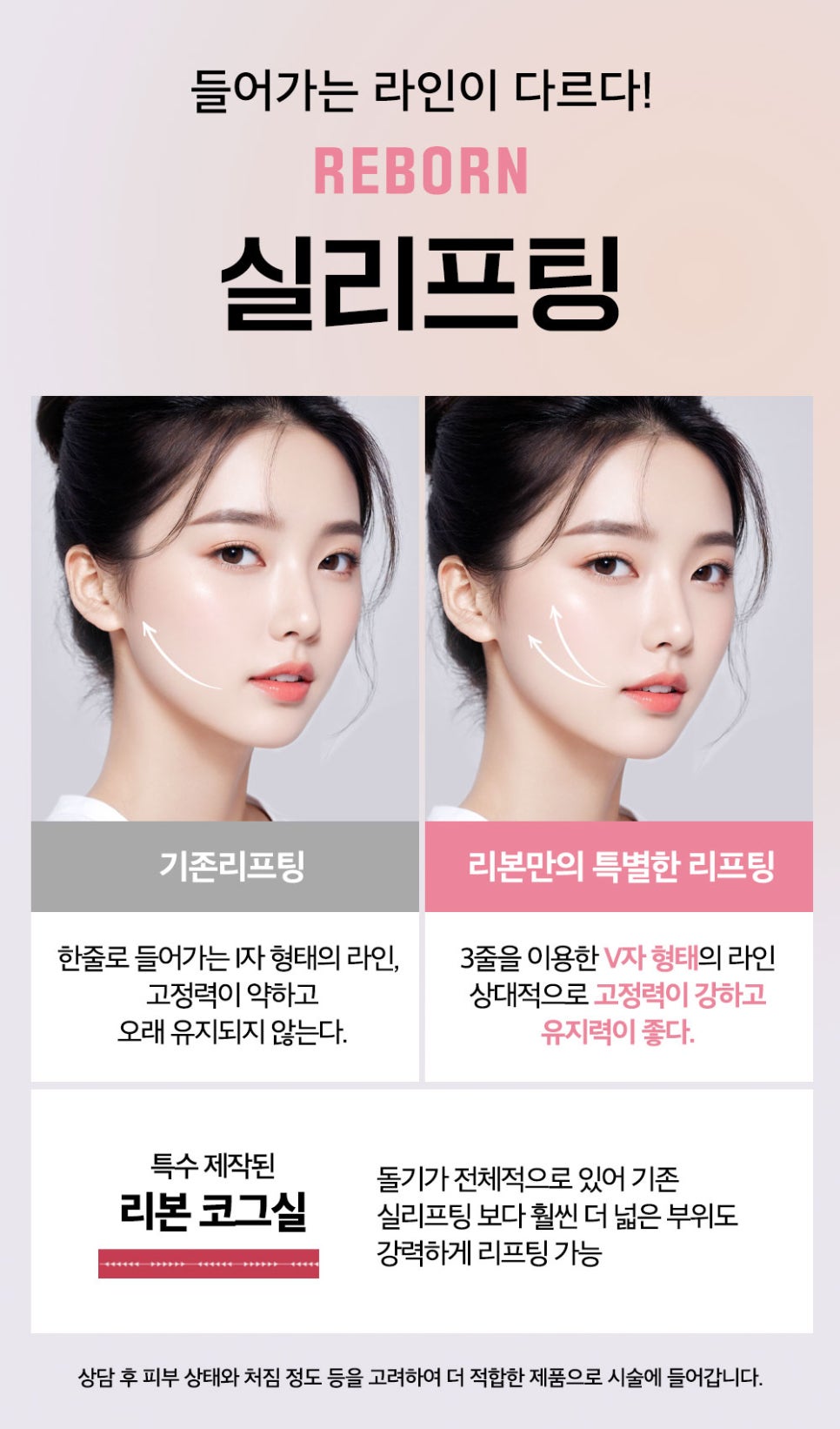 신사역 실리프팅 잘하는 성형외과에서 말하는 실리프팅 A to Z 관련 이미지 5
