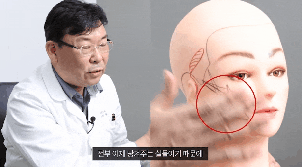 처진 볼, 이중턱 실리프팅 가격 젊어지기 위해 알아보고 있다면 관련 이미지 1