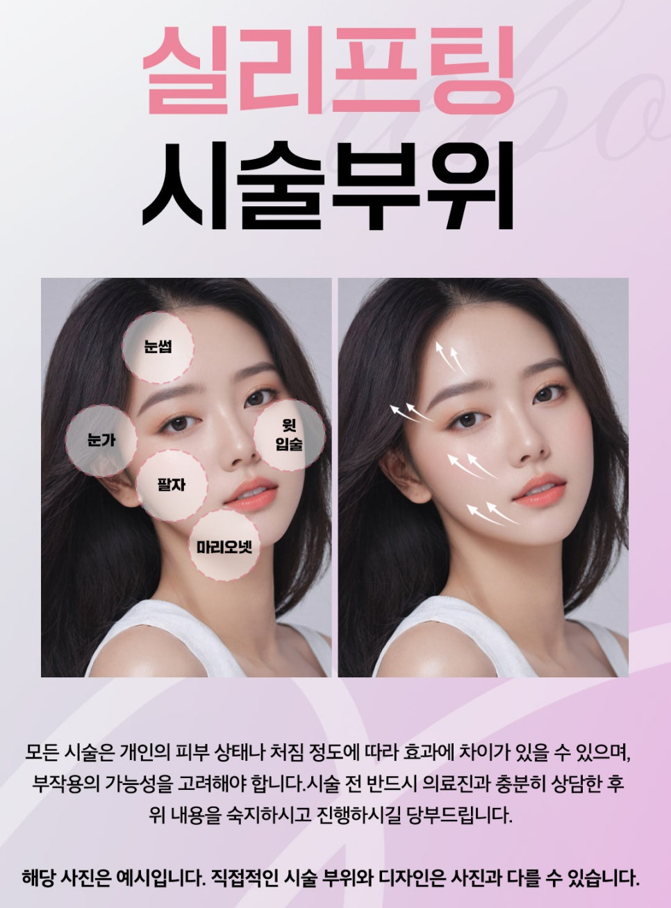 압구정역실리프팅 유지 기간 오래가려면 관련 이미지 2
