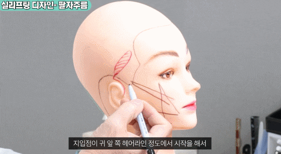 Facelift Surgery Recovery and Scars: What I’d Like to Explain image 1
