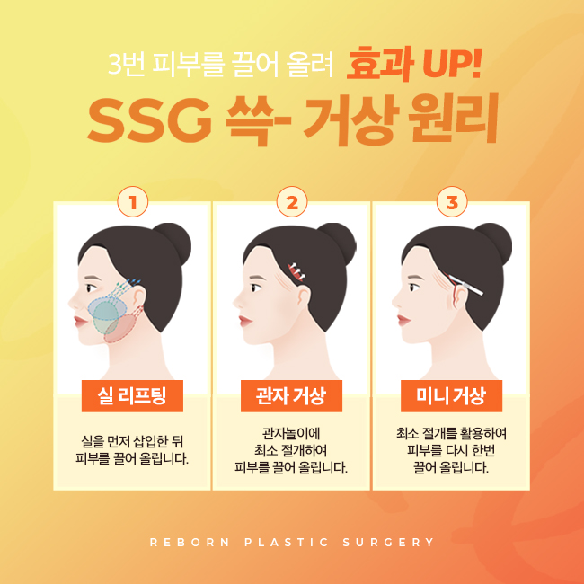 압구정역리프팅 새롭게 관련 이미지 2