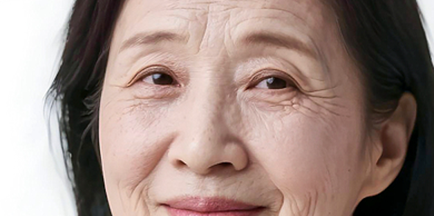 Upper and Lower Blepharoplasty Price: What Is a Reasonable Cost? image 4
