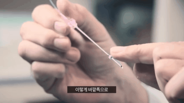 안면거상전후 후기 찾을 때 함께 살펴보세요! 관련 이미지 4