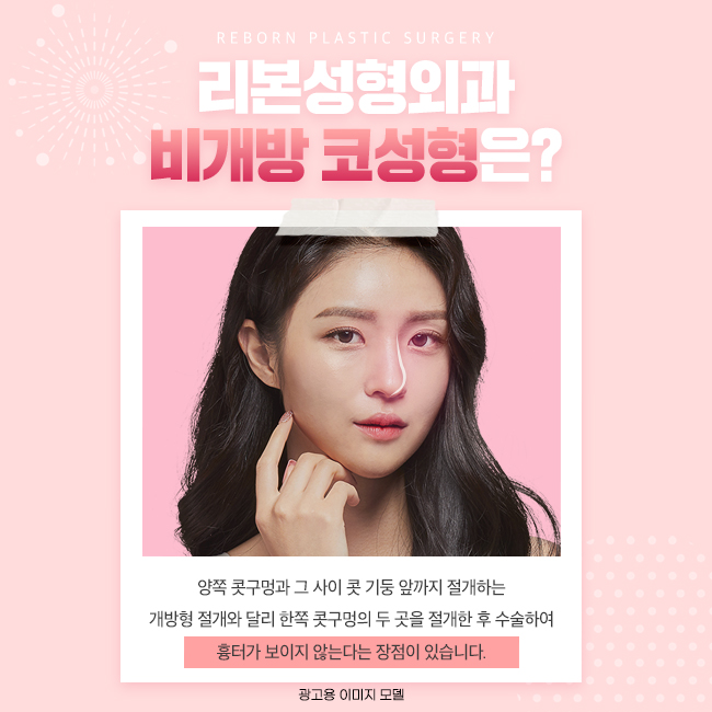 신사역코성형 비개방으로! 관련 이미지 2