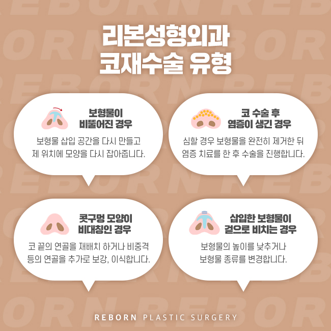 강남코재수술 실패에 걱정하지 말고 관련 이미지 3