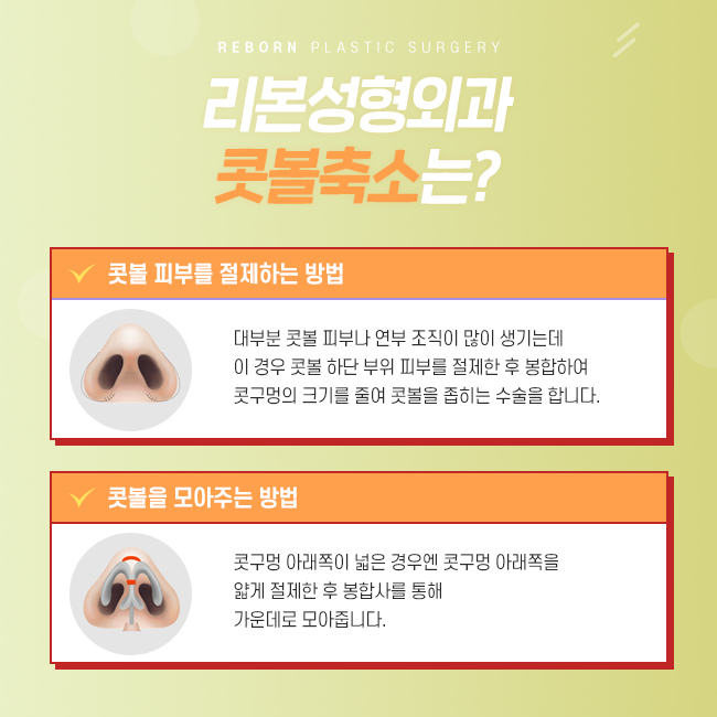 신사역성형외과 예쁜 콧볼로 도전! 관련 이미지 3