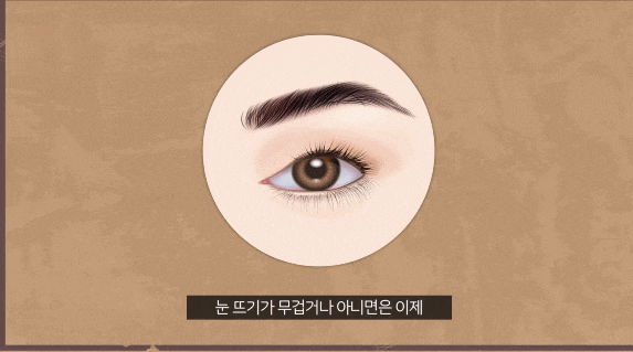 신논현 상안검수술 받을 때 유의사항 말씀드립니다. 관련 이미지 4