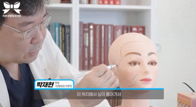 신사역안면거상 부작용, 회복기간, 흉터 걱정되는 분들은 확인하세요. 관련 이미지 3