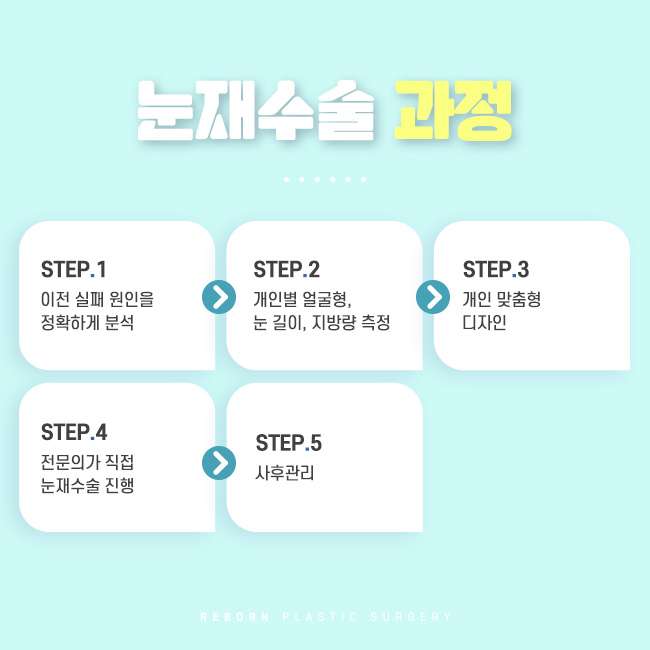 눈재수술잘하는곳 성공하기 위해선 관련 이미지 2