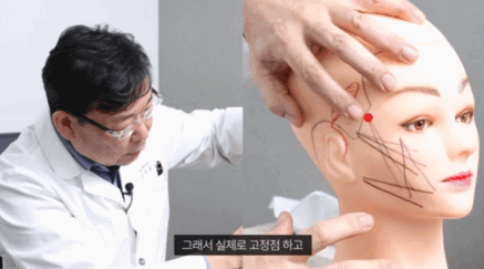 실리프팅 끊어짐? 실리프팅 뚝 소리가 걱정된다면? 관련 이미지 5