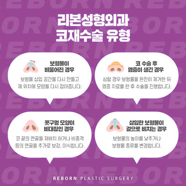 강남역코재수술 케이스에 맞게 해야 관련 이미지 3