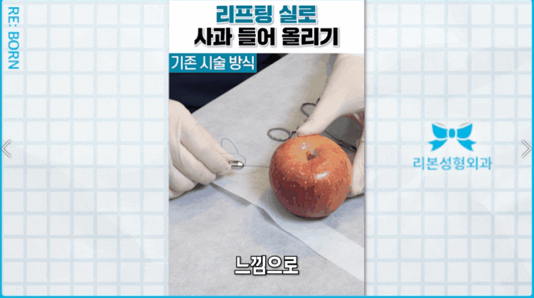 Please read this if you are looking for the best place for thread lifting in Apgujeong image 6